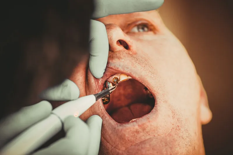 Dental Implant Timeline: A Phase-by-Phase Deployment Guide