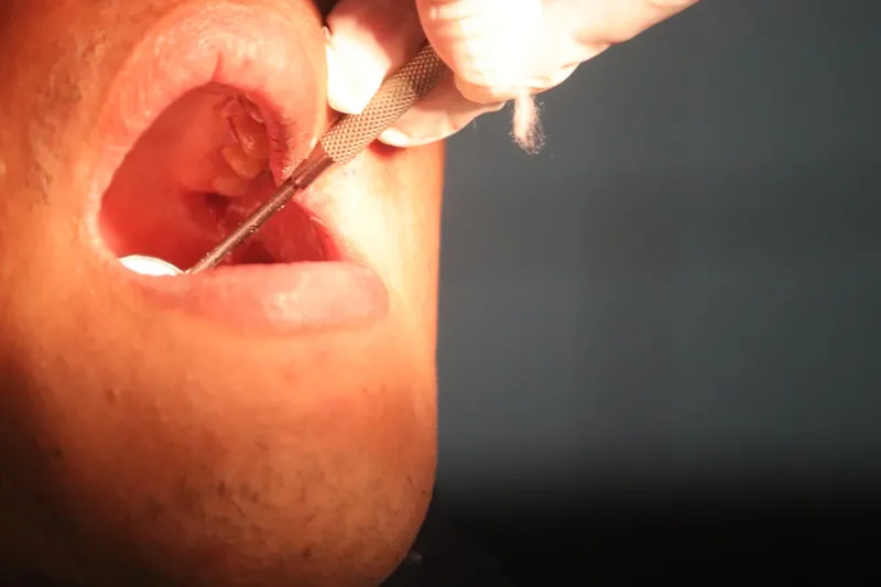 The Precision Flossing Guide: Optimizing Your Interdental Workflow